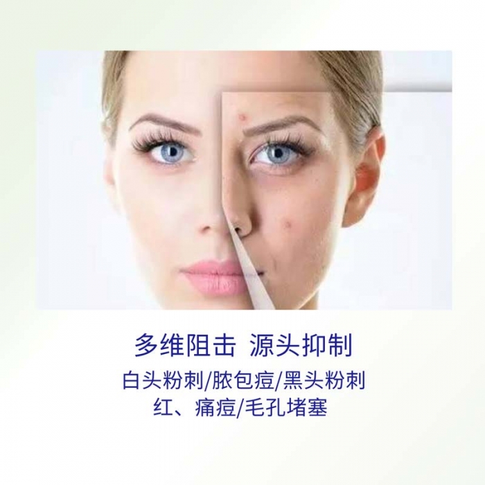 轮播图